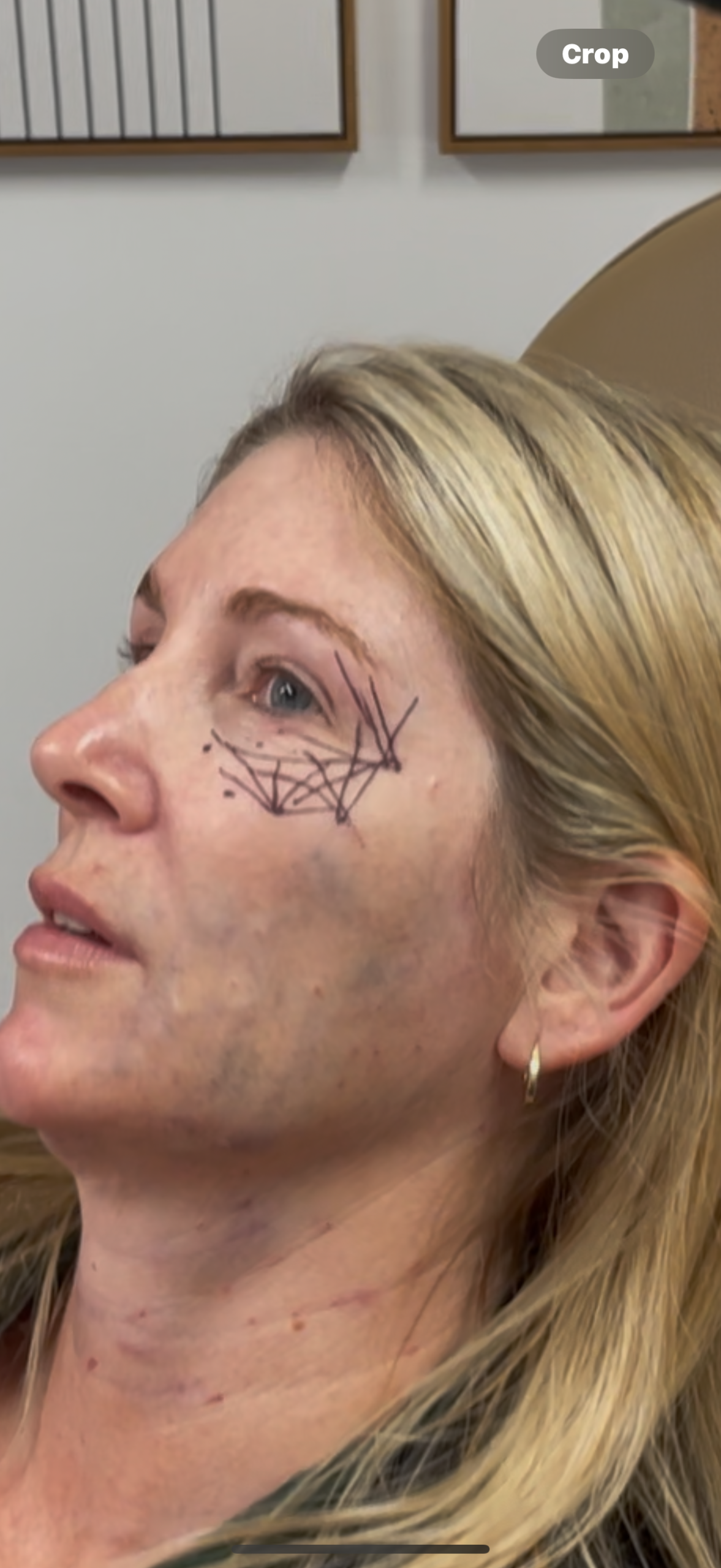 PDO threads before and after example